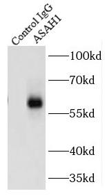      anti- ASAH1 antibody