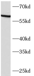      anti- ASAH1 antibody