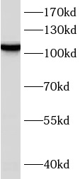      anti- ARTS1 antibody