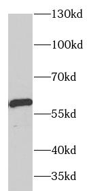      anti- ARSA antibody