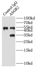      anti- ASGR2 antibody