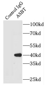 ASBT抗体