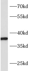 anti- ASBT antibody