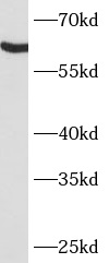      anti- ARSG antibody