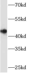      anti- ARSB antibody