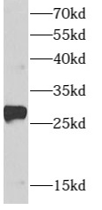      anti- ARMC7 antibody