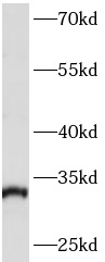 anti- ARPC2 antibody