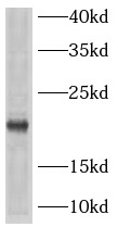      anti- ARPC5 antibody