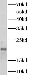      anti- ARPC3 antibody