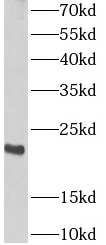      anti- ARPC4 antibody