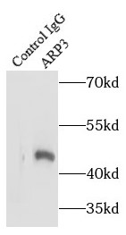ARP3抗体