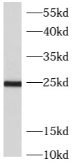      anti- ARL5B antibody