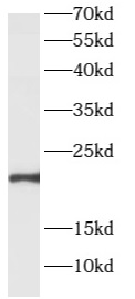      anti- ARL2BP antibody