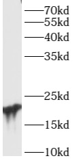      anti- ARL15 antibody