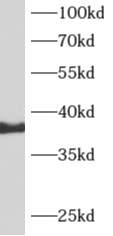      anti- ARFIP2 antibody