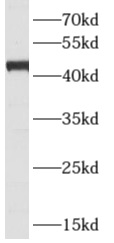      anti- ARFIP1 antibody