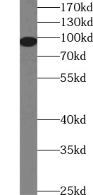      anti- ALDH1L1 antibody