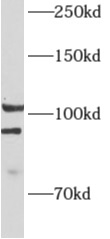      anti- ALDH1L2 antibody