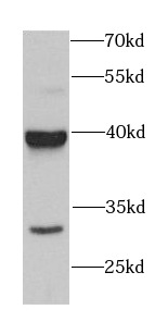      anti- ASNA1 antibody