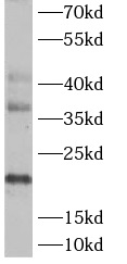      anti- ASF1A antibody