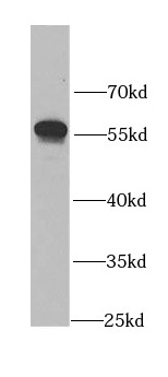      anti- ALDH3A1 antibody