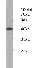      anti- ASGR1 antibody