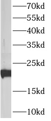      anti- ATP5H antibody