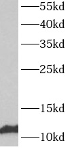      anti- ATP5L antibody