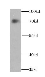      anti- ATF2 antibody