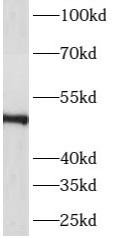      anti- ASZ1 antibody