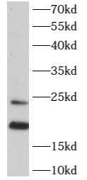 anti- ARL2 antibody