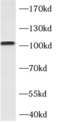      anti- ALCAM antibody