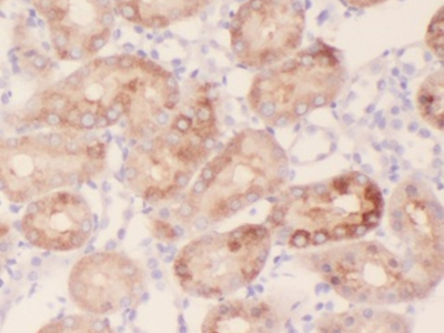 anti- AKAP14 antibody