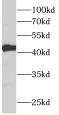      anti- ALDH3B2 antibody