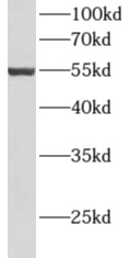      anti- ALDH3A2 antibody