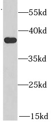      anti- AKR1A1 antibody