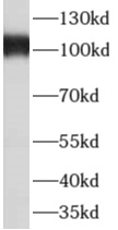      anti- AKAP3 antibody