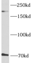      anti- AKAP12 antibody