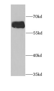 anti- ALADIN antibody