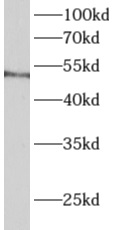      anti- ALDH3B1 antibody