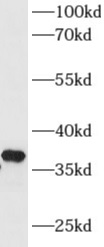      anti- AKR1D1 antibody