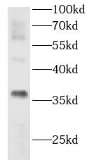 anti- AKR1CL2 antibody