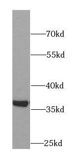      anti- AKR1B1 antibody