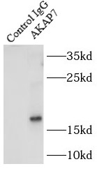      anti- AKAP7 antibody