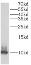      anti- AKAP7 antibody