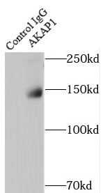 anti- AKAP1 antibody