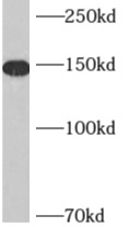 anti- AKAP1 antibody