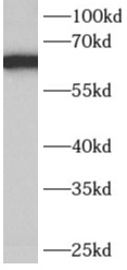 anti- AK5 antibody