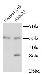      anti- AHSA1 antibody