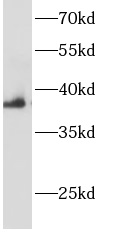      anti- AHSA1 antibody